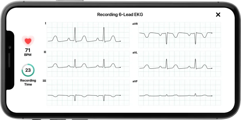 KardiaMobile 6L Personal EKG Monitor with Most Smartphones - Image 4