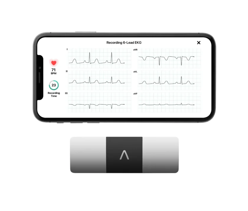 KardiaMobile 6L Personal EKG Monitor with Most Smartphones